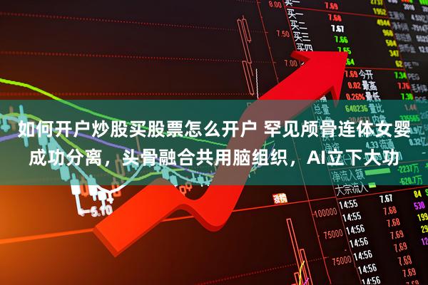 如何开户炒股买股票怎么开户 罕见颅骨连体女婴成功分离，头骨融合共用脑组织，AI立下大功